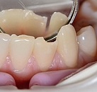 Лечение зубов какая стоматология thumbnail