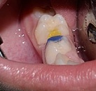 Детская клиника лечения зубов