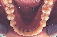 Стоматология брекеты лечение зубов
