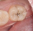 Лечение зубов клиника все свои thumbnail