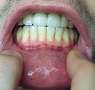 Лечение зубов и десен в спб thumbnail