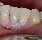 Договор лечения зубов в клиники все свои thumbnail
