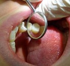 Стамотология и все о лечение зубов