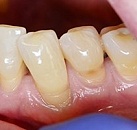 Диагностика и лечение зубов thumbnail