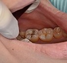 Ваша стоматология лечение зубов