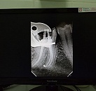 Диагностика и лечение зубов
