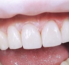 Стоматология все о лечение зубов