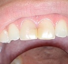 Средство по лечению зуба thumbnail