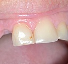 Сеансы по лечению зубов thumbnail