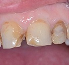 Ваша стоматология лечение зубов thumbnail
