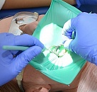 Лечение каналов зуба под микроскопом акция