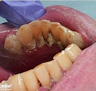 Ваша стоматология лечение зубов