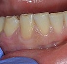 Лечение зубов клиника все свои