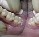 Лечение зубов какой стоматолог