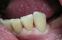 Не откладывайте лечение зубов