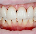 Какое есть лечение зубов