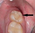 Заявка на лечение зубов thumbnail