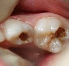 Детская клиника лечения зубов