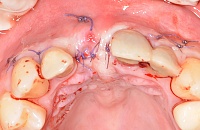 Хирург в стоматологии при лечении зубов