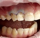 Стамотология и все о лечение зубов