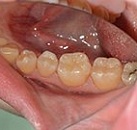 Лечение зубов какой стоматолог