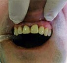 Лечение зубов в долго