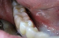 Зубы человека лечение стоматология