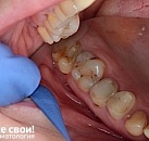 Не откладывайте лечение зубов