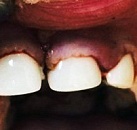 Детский стоматолог лечение зубов