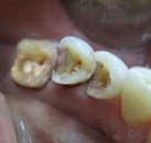 Лечение зуба это какая стоматология thumbnail