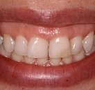 Лечение зубов и десен в спб