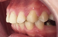 Стоматология брекеты лечение зубов