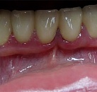Хирург в стоматологии при лечении зубов