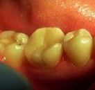 Лечение зубов все включено thumbnail
