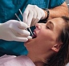 Киста зуба лечение в петербурге