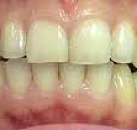 Лечение зубов и десен в спб