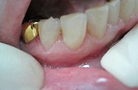Лечение зуба это какая стоматология
