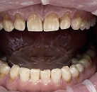 Стоматолог и лечение зуба thumbnail