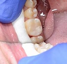 Стамотология и все о лечение зубов thumbnail