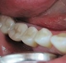 Карта для лечения зубов thumbnail