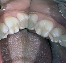 Лечение зубов в стомотологической клинике thumbnail