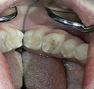 Современная стоматология лечение зубов thumbnail