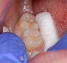 Стоматология все о лечение зубов