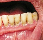 Хирургическое лечение зубов москва