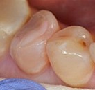 Стоматология строение лечение зубов thumbnail