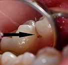 Эта стоматология по лечению зубов поможет вам thumbnail