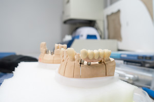 Керамические коронки на зубы