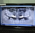 Диагностика и лечение зубов